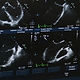 Ultrasound Scan Display
