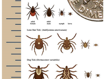 Ticks & Lyme Disease