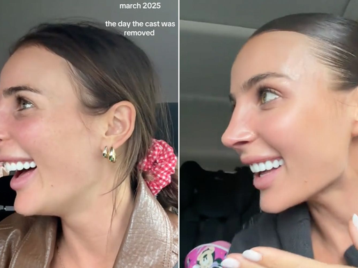 Influencer Indy Clinton Finally Shares Her Second Nose Job Results and Addresses Controversy Over Charging for the Full Story