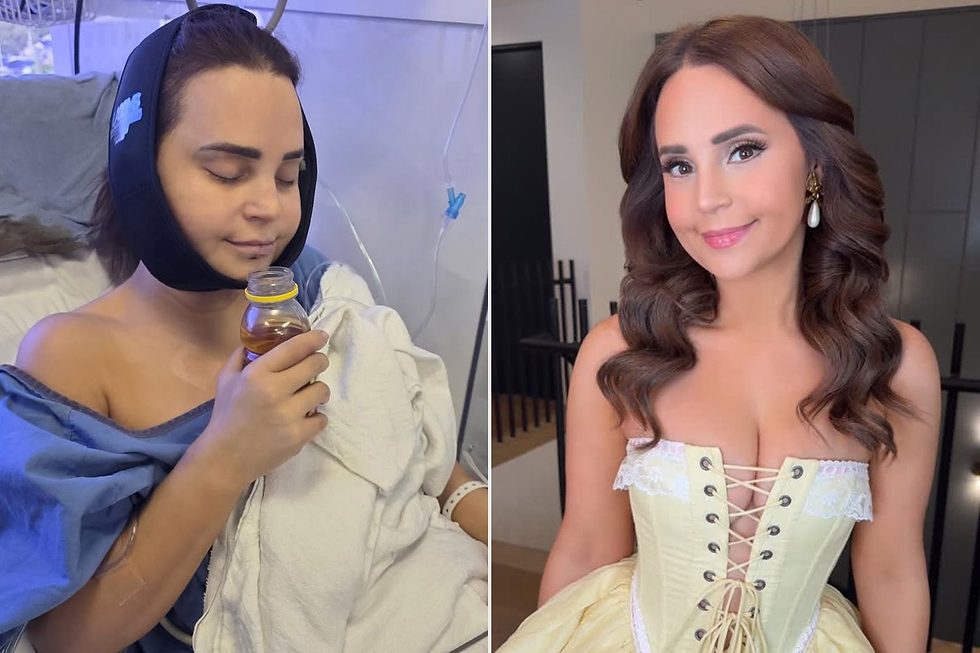 Rosanna Pansino Reveals Serious Injuries After Falling From a Boat on Her Birthday