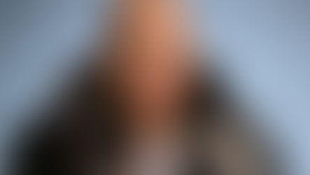 Jordan James Parke’s Final Chapter Was Marked by Warnings About His Plastic Surgery Addiction