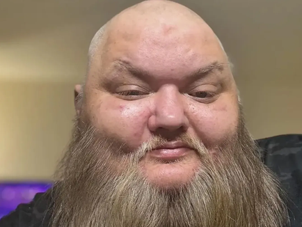 John Crawley, known to millions as KingBeard X, lost his life at 47 after a courageous two-week ICU battle