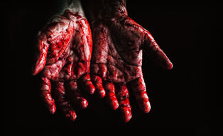 Resign, you have blood on your hands