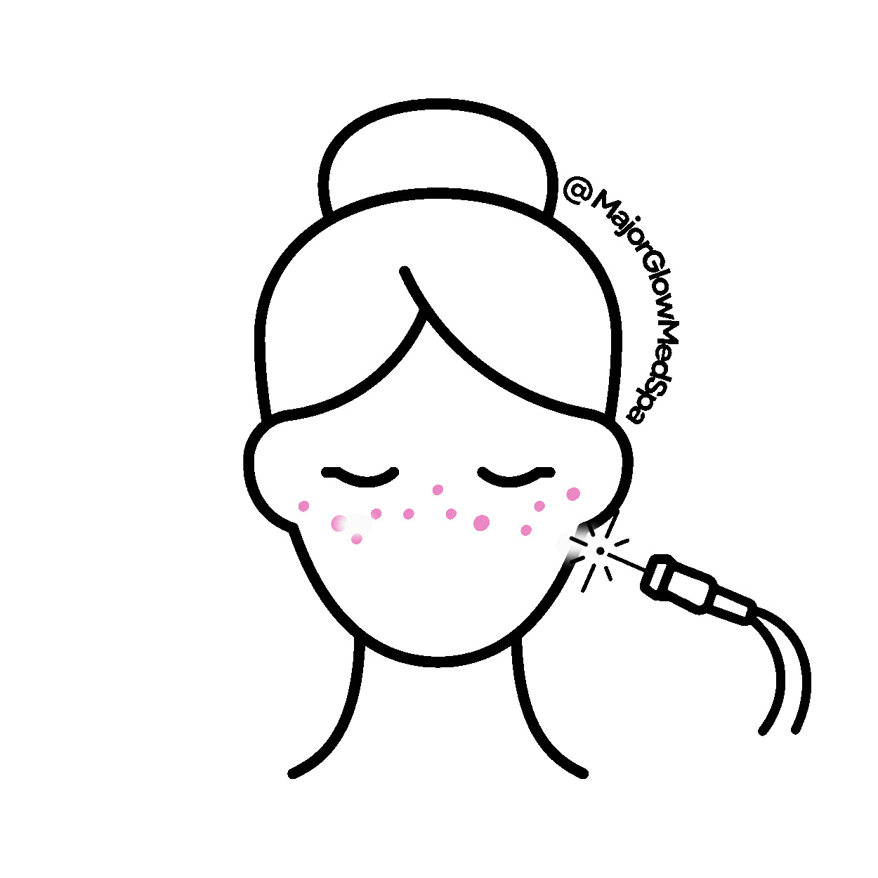 Laser Pigmentation (2).gif