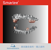 機能的矯正装置 Smartee（スマーティー） | 湘南鎌倉歯科・矯正歯科