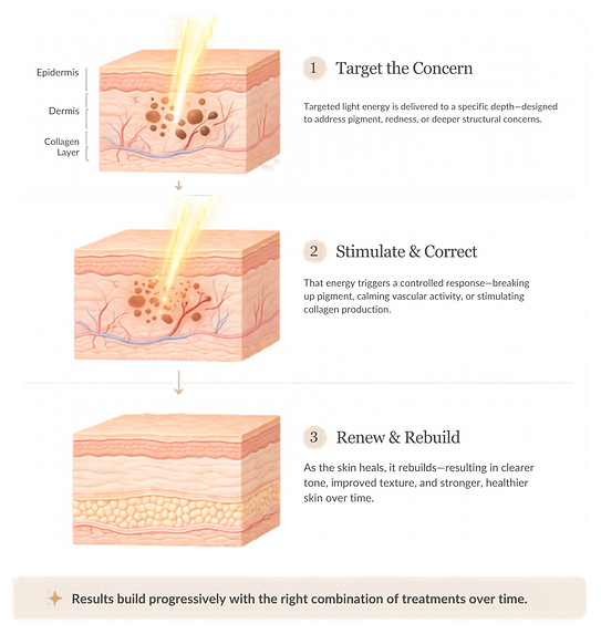 Untitled design (5)_edited.png