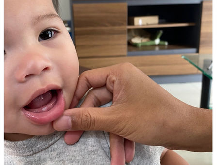 Grandbaby’s first tooth