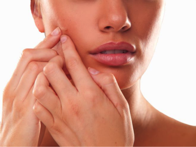 Causes of  Have Adult Acne, and Ways to Get Rid of It
