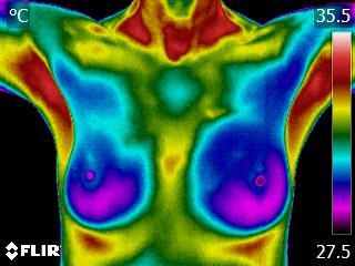 Breast Health - We Can Take Charge!