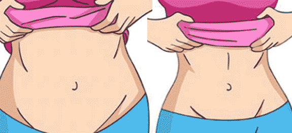 transverse et ventre plat