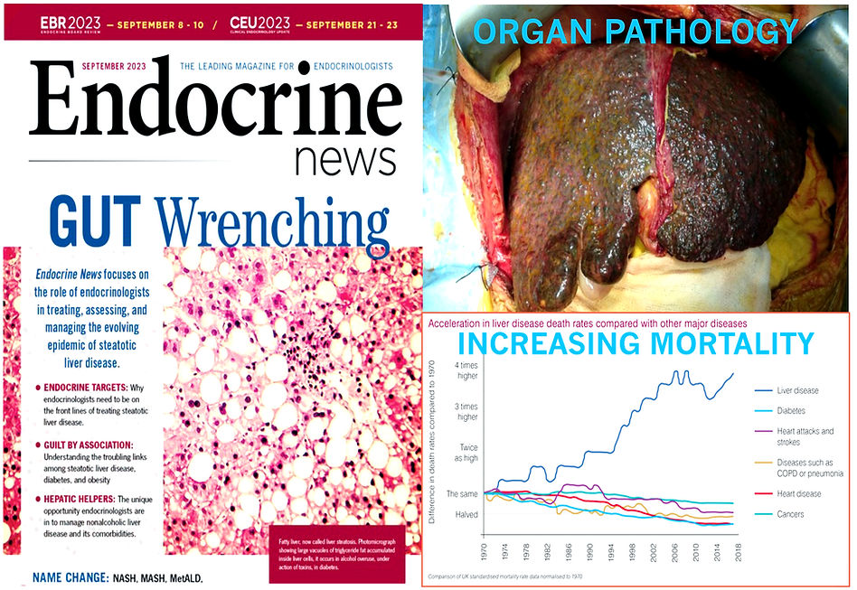Cycle of liver failure 2_edited.jpg