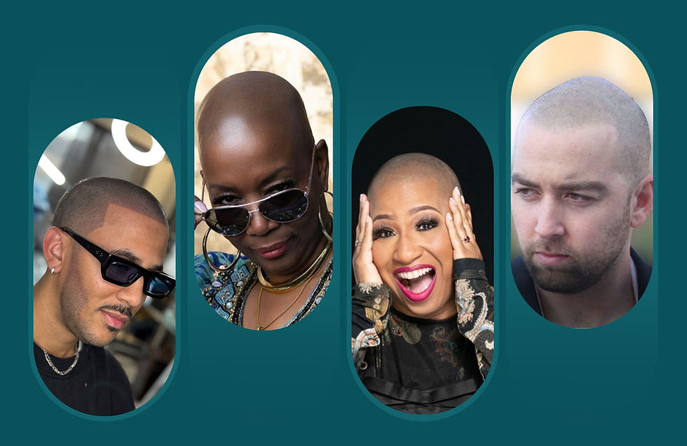 Scalp Micropigmentation Hair Loss Stylish designed gallery