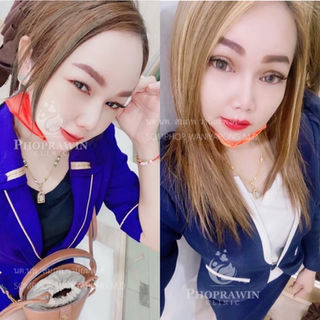 รีวิวทำตาสองชั้น
