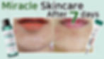 Thumbnail: [ SOME BY MI ] AHA BHA PHA 14 Days Super Miracle Spot All Kill Cream 30ml
