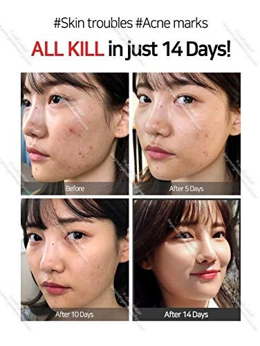 Thumbnail: [ SOME BY MI ] AHA BHA PHA 14 Days Super Miracle Spot All Kill Cream 30ml