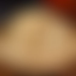 Exploring the Lesser Known Benefits of Astragalus in Modern Herbal Medicine