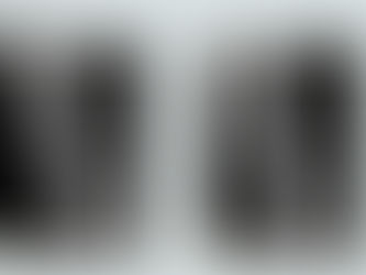 立って撮る膝(ひざ)関節について