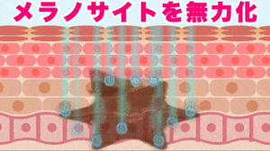 1ダウンロード.gif