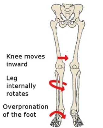 How To Fix Your Flat Feet Best 4 Exercises