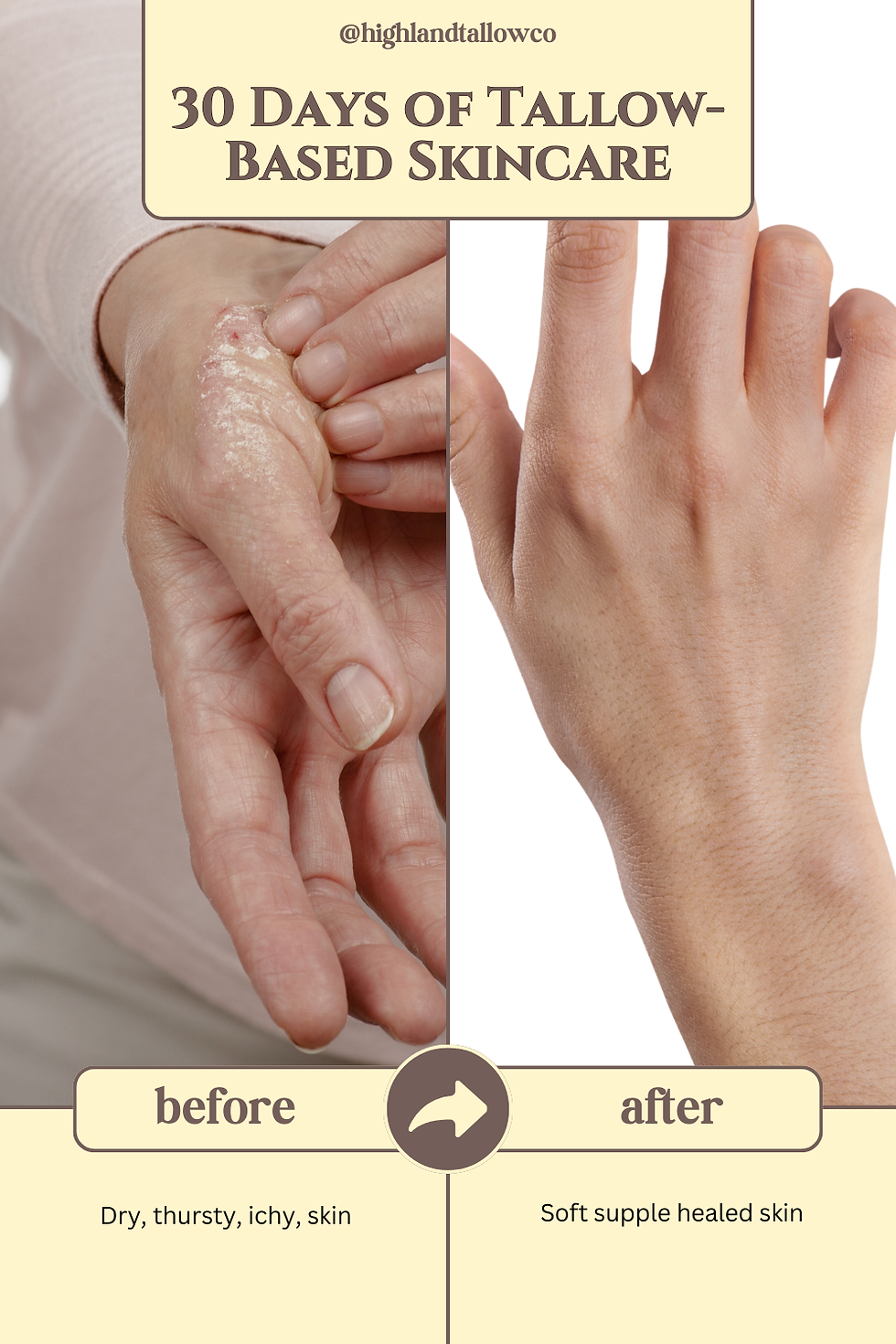 30 Days of Tallow Skincare: a before and after two photos of hands; before dry skin, after smooth, healthy skin
Highland tallow co tallow lotion