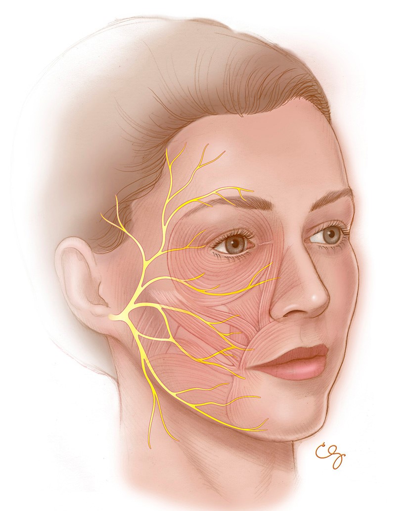 Facial Nerve | Facial Palsy SA