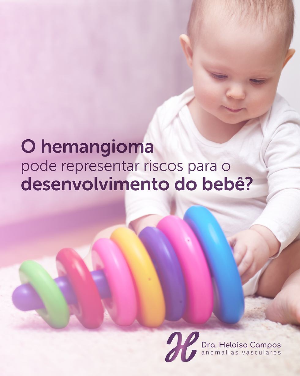 hemangioma da infância