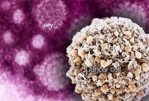 Warts Vs Skin Cancer