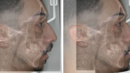 Crescimento e Desenvolvimento Facial: como acontece?