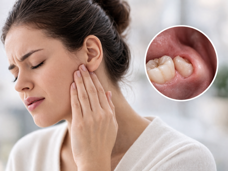 Dor no fundo da boca: pode ser dente do siso? Entenda as causas