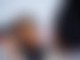 What Happens If You Don’t Treat A Concussion?