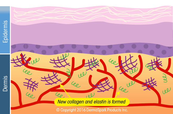 Micro-needling  Renewed Skin