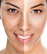 OxyGeneo facial at Epiphany Spa Oakville