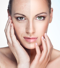 skin before and after.jpg