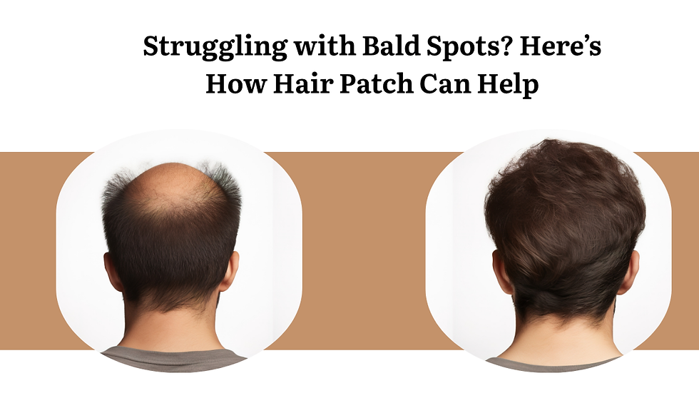 Hair patch in Jaipur
