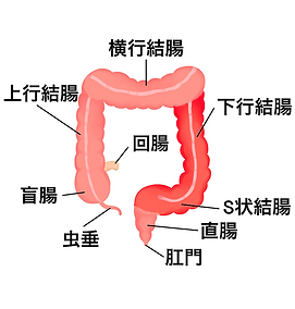 虚血性腸炎について