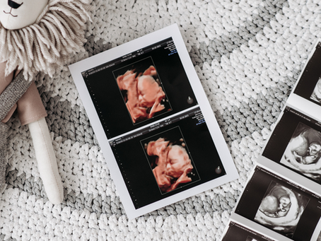 Assisted Reproductive Technology Law in Washington
