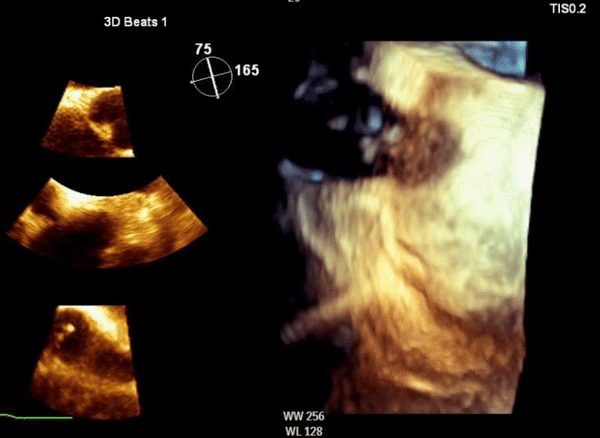 Q4-3D-TEE-with-2Ds-RA-120deg-gold-scale.gif