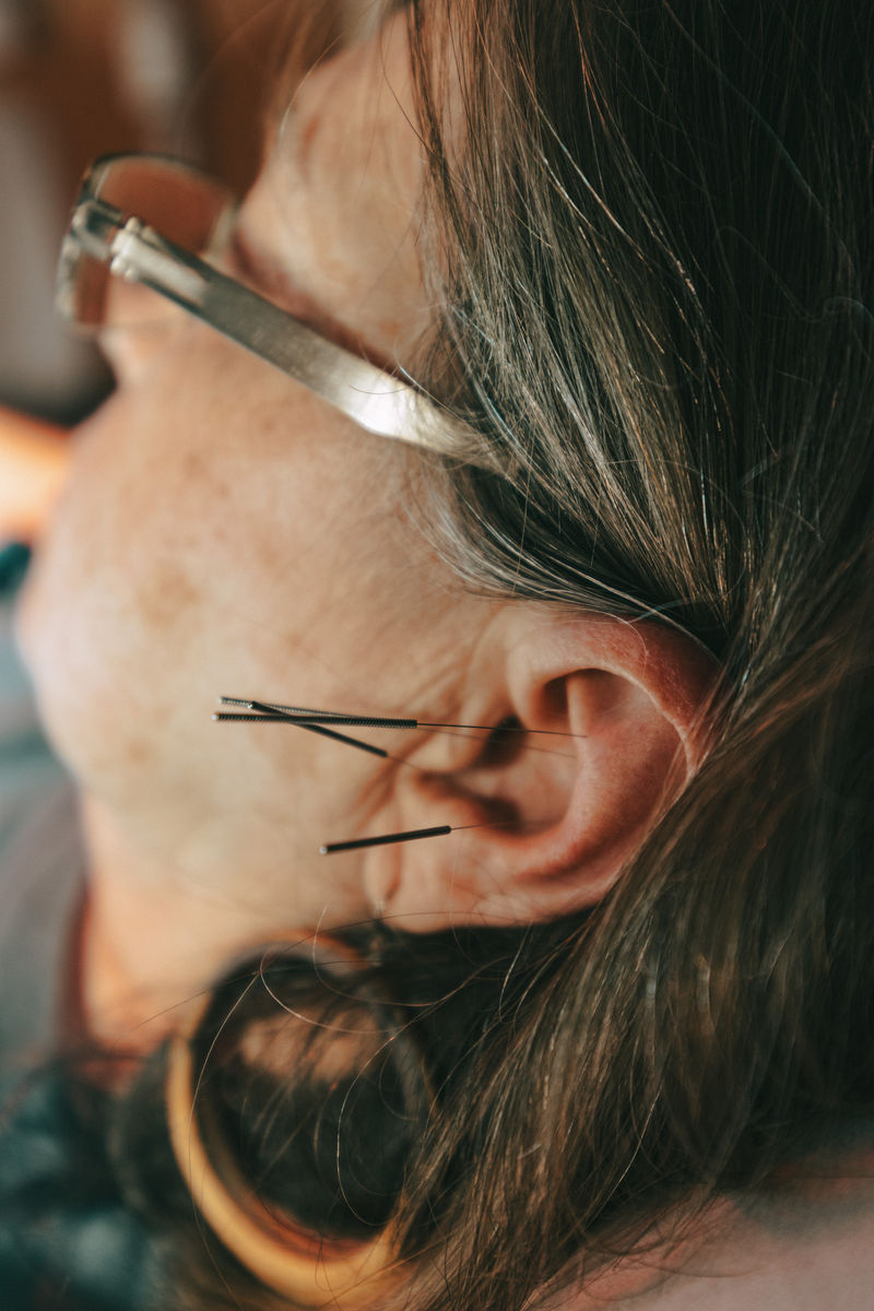 Boise Acupuncture Co-op