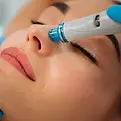 Hydrafacial Pic.webp