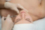 close up woman lip filler procedure.