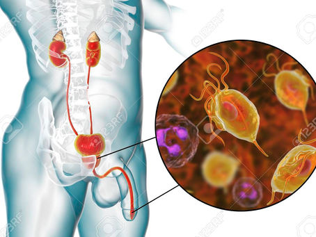 Uretritis en hombres