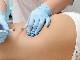Mesoterapia: facial, corporal y capilar