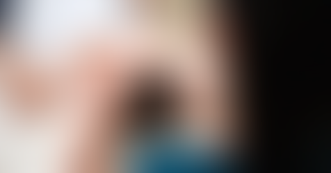 Os efeitos das Barras de Access na depressão e ansiedade