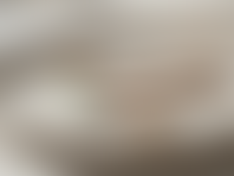 Understanding Dermaplaning Treatment Costs