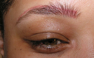red discoloured brow tattoo