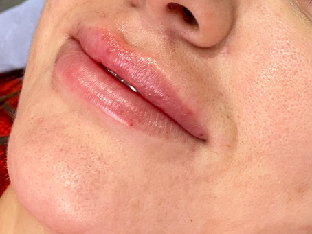 Exploring Aesthetic Services in the UK