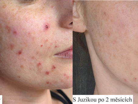Juzika recenzia