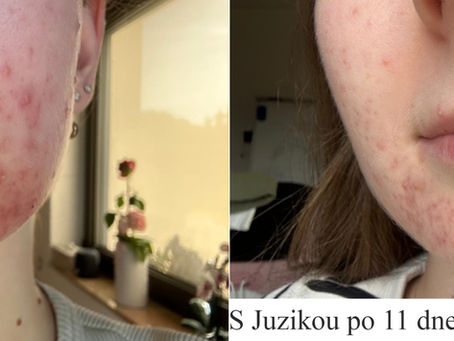 Juzika skúsenosť
