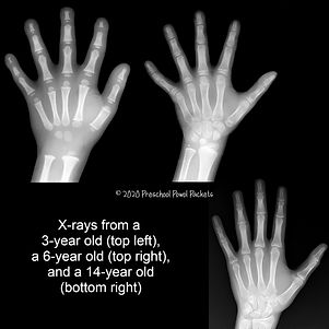 x-rays for preschool hands.jpeg