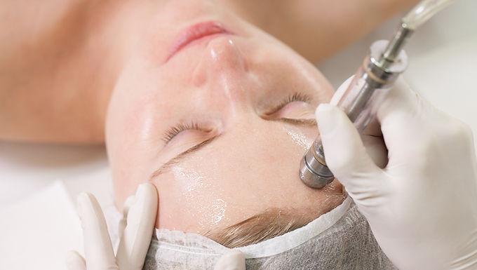 Microdermabrasion